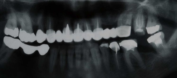 Do The Director Disqualification Compensation Order Rules Have Teeth